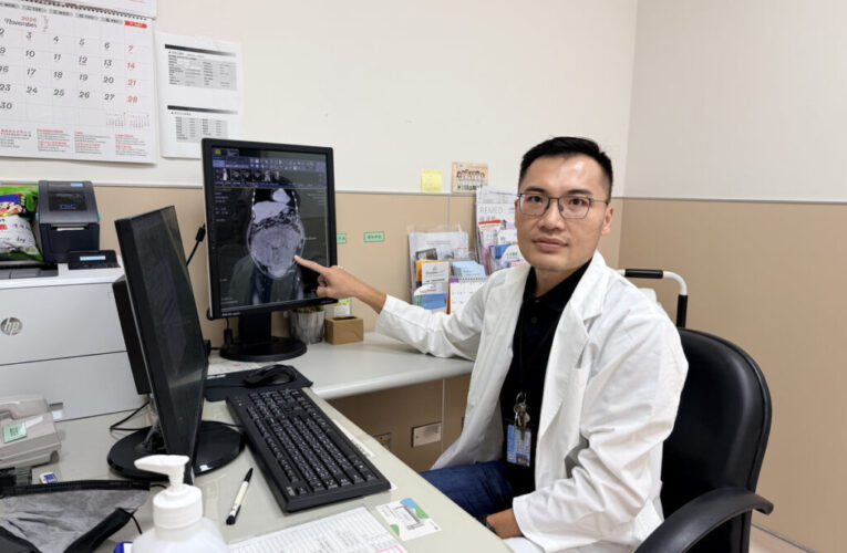 52歲婦腹部異常脹大　檢查驚見26公分巨大子宮肌瘤　跨科團隊合作成功摘除